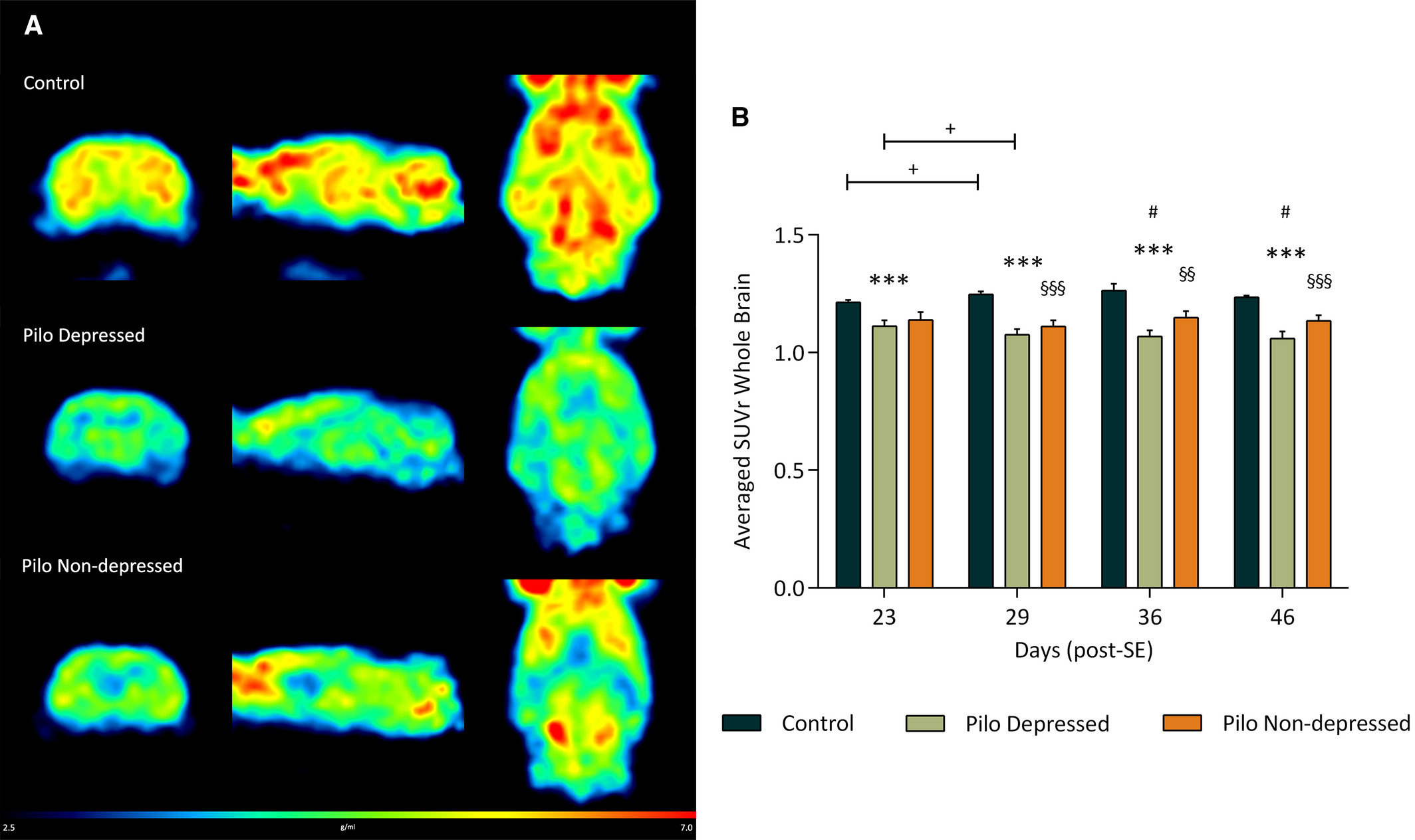 MicroPET test images show a reduction in glucose metabolism in both groups of epileptic animals, with and without depression, as compared to healthy groups. The warmer colors (red-yellow) mean higher glucose consumption in the brain whereas colder ones (green-blue) indicate lower consumption. However, the decrease in brain activity is higher in the group with both pathologies./Image: Epilepsia journal
